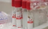Ученые Петербурга разрабатывают съедобную вакцину от гриппа