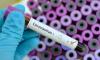 "Вектор" выявил новый изолят южноафриканского штамма коронавируса