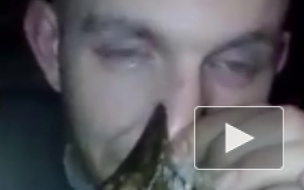 Кровавое видео: Щука вцепилась мертвой хваткой в нос рыбака