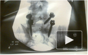 Евгению Плющенко делают операцию