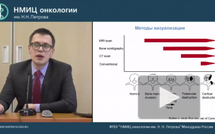 Метастазы в позвоночнике