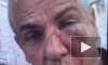 Сами Насери после избиения в центре Москвы прооперировали глаз
