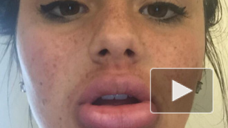 Адский флэшмоб #kyliejennerchallenge калечит участников, но люди продолжают уродовать себя