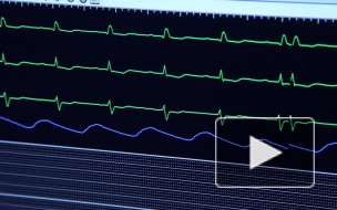 Трехлетний мальчик выпал из окна и тяжело травмировал голову в Петербурге