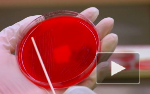 Число инфицированных ВИЧ в России превысило 1 млн человек