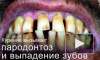 Страшные картинки на пачках сигарет появятся в России с июля 2012 года