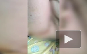 Врачи не обращали внимание на гной в ране пациентки Елизаветинской больницы, пока ее мама не выложила видео в Интернет