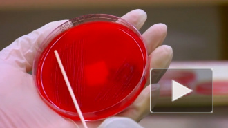 Число инфицированных ВИЧ в России превысило 1 млн человек