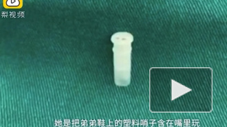 Проглоченная игрушка заставила ребенка пищать подобно дельфину