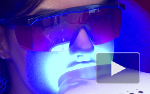 Улыбку Джоли хотят мои клиентки, - рассказывает эксперт по отбеливанию зубов