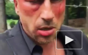 Побои Дмитрия Нагиева не остались незамеченными