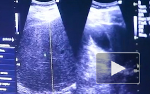 Названы самые "жирующие" регионы России